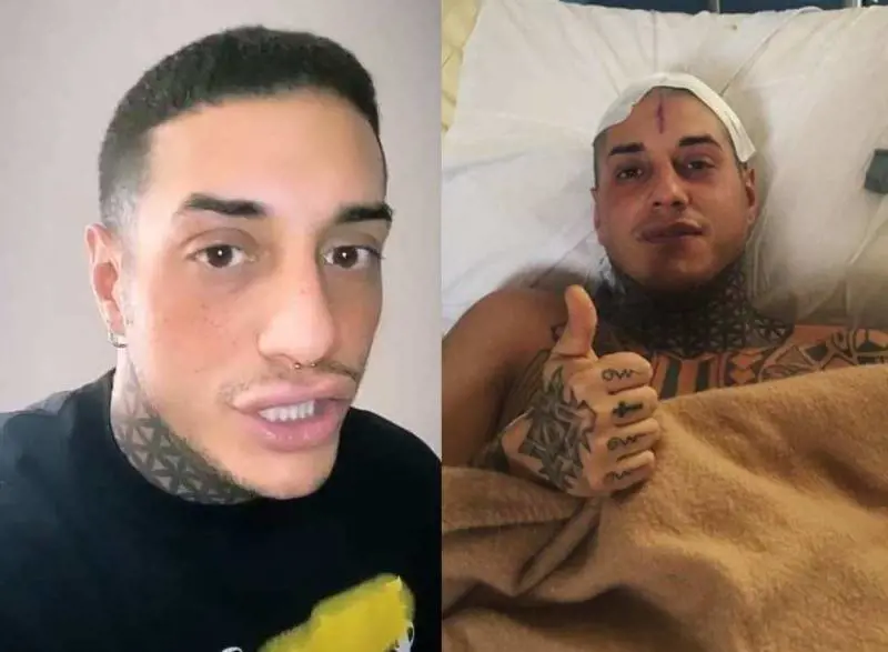 Francesco Chiofalo svela: "Prima di rimuovere il tumore ho pensato di farla finita"