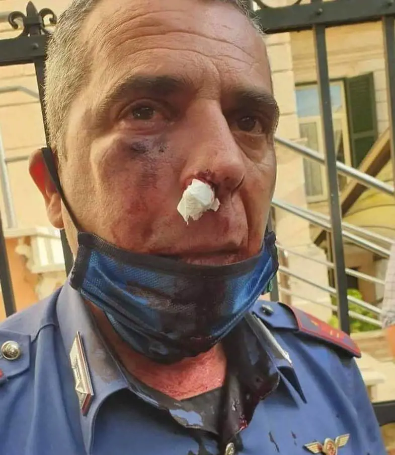Il migrante che ha spaccato la faccia al militare aveva il reddito di cittadinanza
