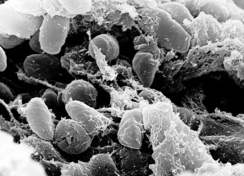 Peste bubbonica, uomo contagiato dal gatto: ecco i sintomi e come colpisce