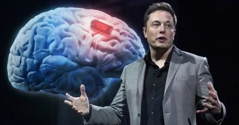 Il chip nel nostro cervello