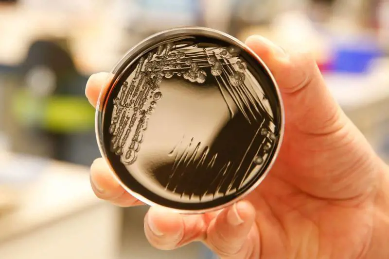 Polmonite? Arriva con l'acqua Perché ora è scoppia l'allarme