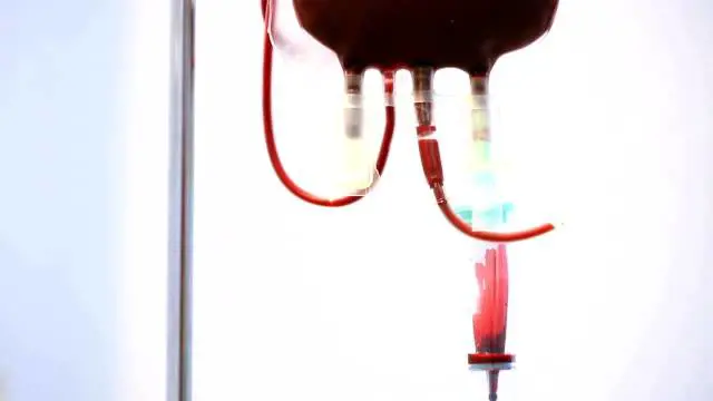 Trapianto di midollo osseo, cos'è e come avviene