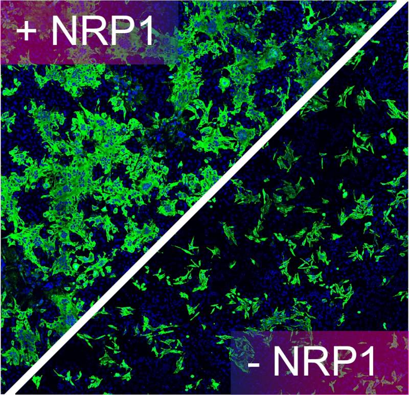 Infezione Sars-CoV-2 tramite NRP1