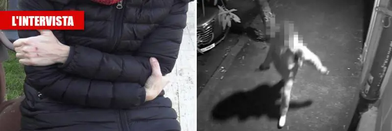"Mi leccava la faccia, poi quel morso e con le mani...", il racconto choc della donna aggredita all'Esquilino