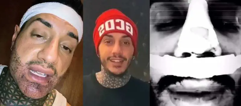 Ennesimo ritocchino per Francesco Chiofalo. Il web lo batosta: "Ma che problemi hai?"