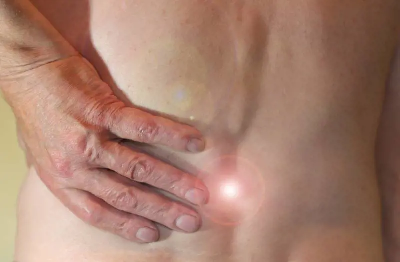 Sciatica: cause e come curarla con rimedi naturali veloci