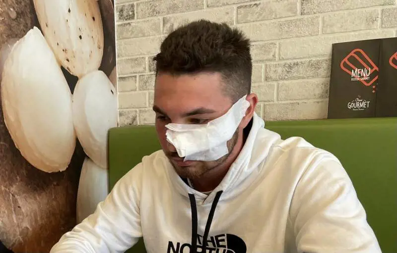 Il rider sfregiato: "Mi ha chiamato solo Salvini. La sinistra? In silenzio"
