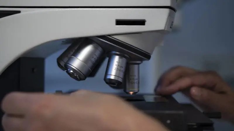 Tumori aggressivi, meno movimento delle cellule limita le metastasi