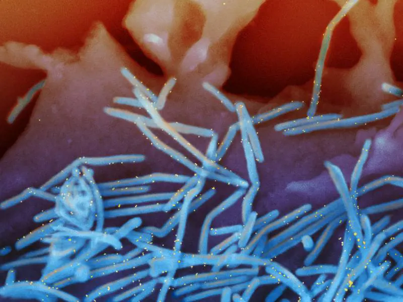 Virus respiratorio sinciziale: cos'è successo ai bimbi con il lockdown
