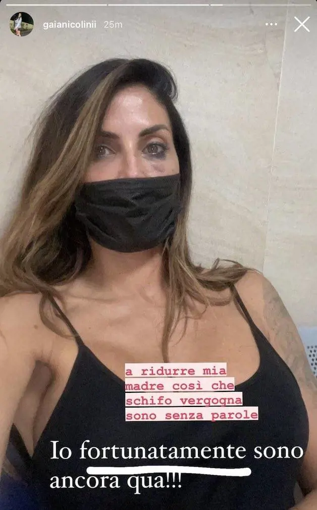 "Ridurla così…". Il volto tumefatto, poi la foto di Guendalina Tavassi sparisce