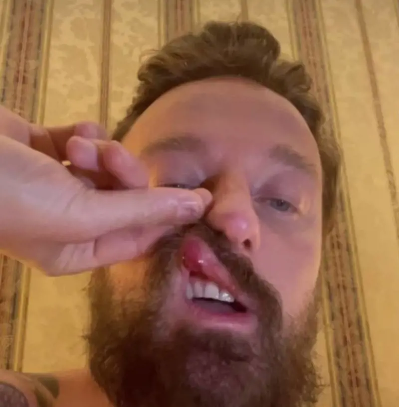 McGregor aggredisce Facchinetti: "Potevo morire..."