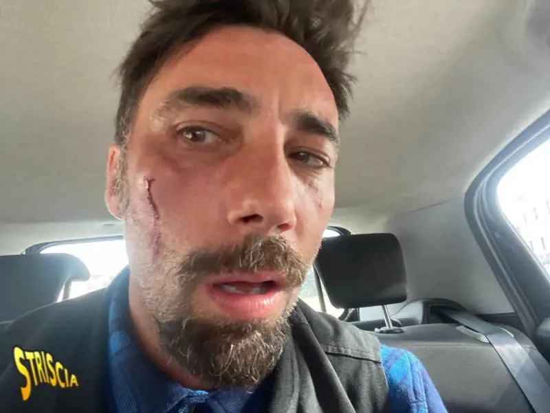 "Ha mostrato i genitali alla telecamera": arrestati gli aggressori di Brumotti