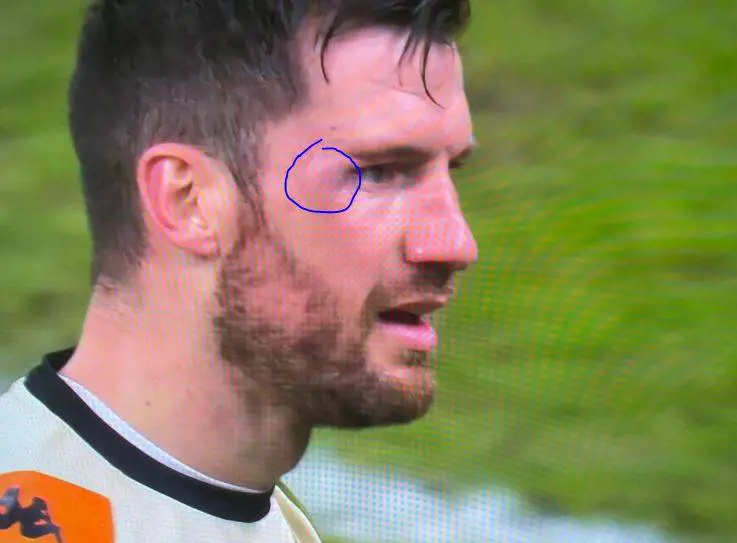 Furia social sul gol dell'Inter: "Gomitata di Dzeko". Ecco cosa poteva fare il Var