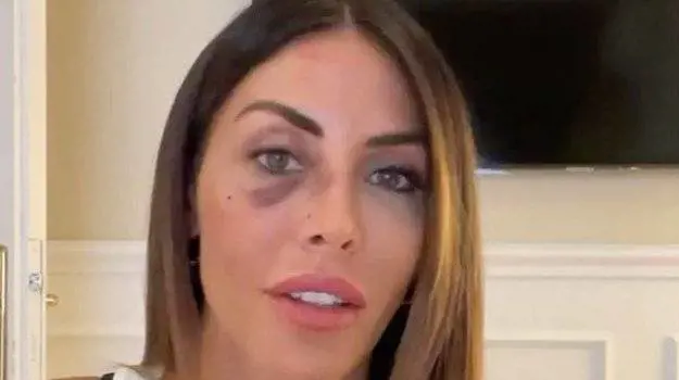 Tavassi rivela le violenze subite dall’ex marito: “Parlo per tutelare bambini traumatizzati”