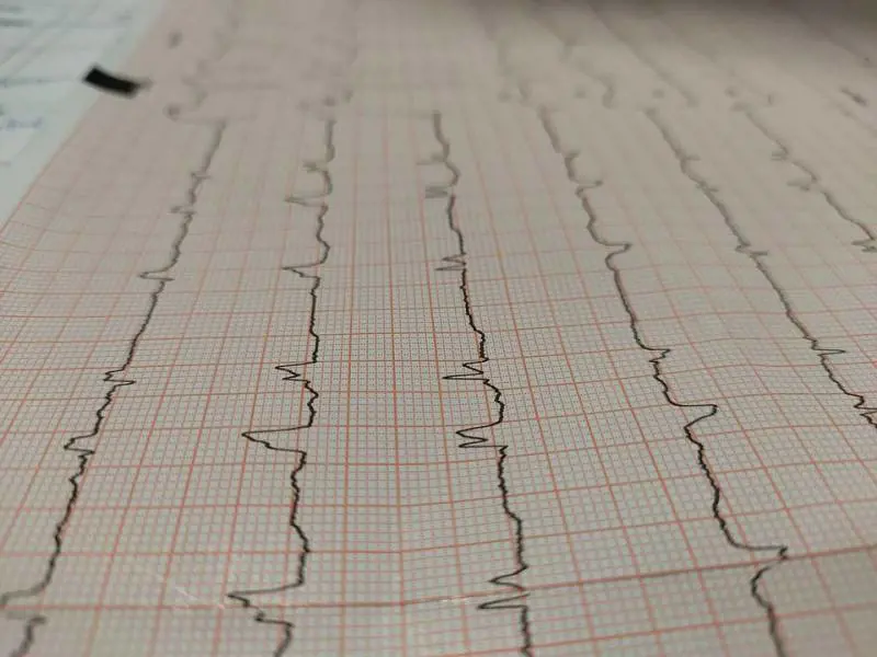 Infarto, qual è la proteina che "ripulisce" le arterie del cuore