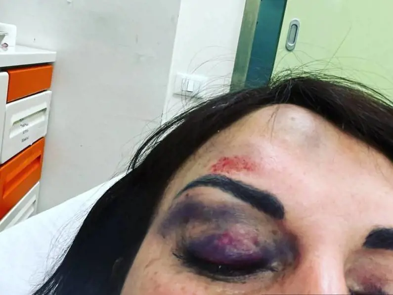 Divieto di avvicinamento per l'ex di Francesca De André dopo le aggressioni