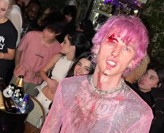 Si spacca un bicchiere di vetro in testa e continua a cantare. La follia di Machine Gun Kelly