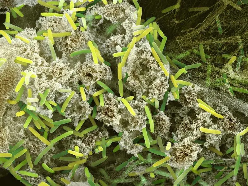 Incubo listeria, l'esperto: "Ecco a cosa fare attenzione"
