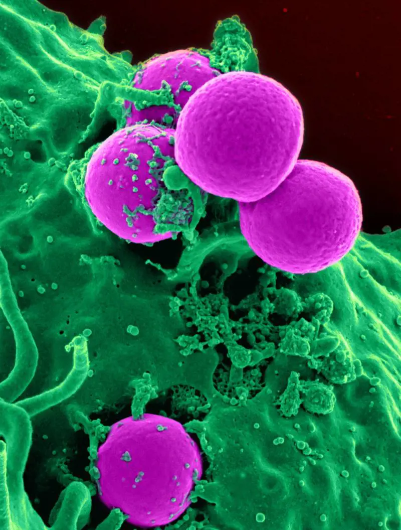 Psicobiotici, ecco i batteri (intestinali) che regolano l'umore