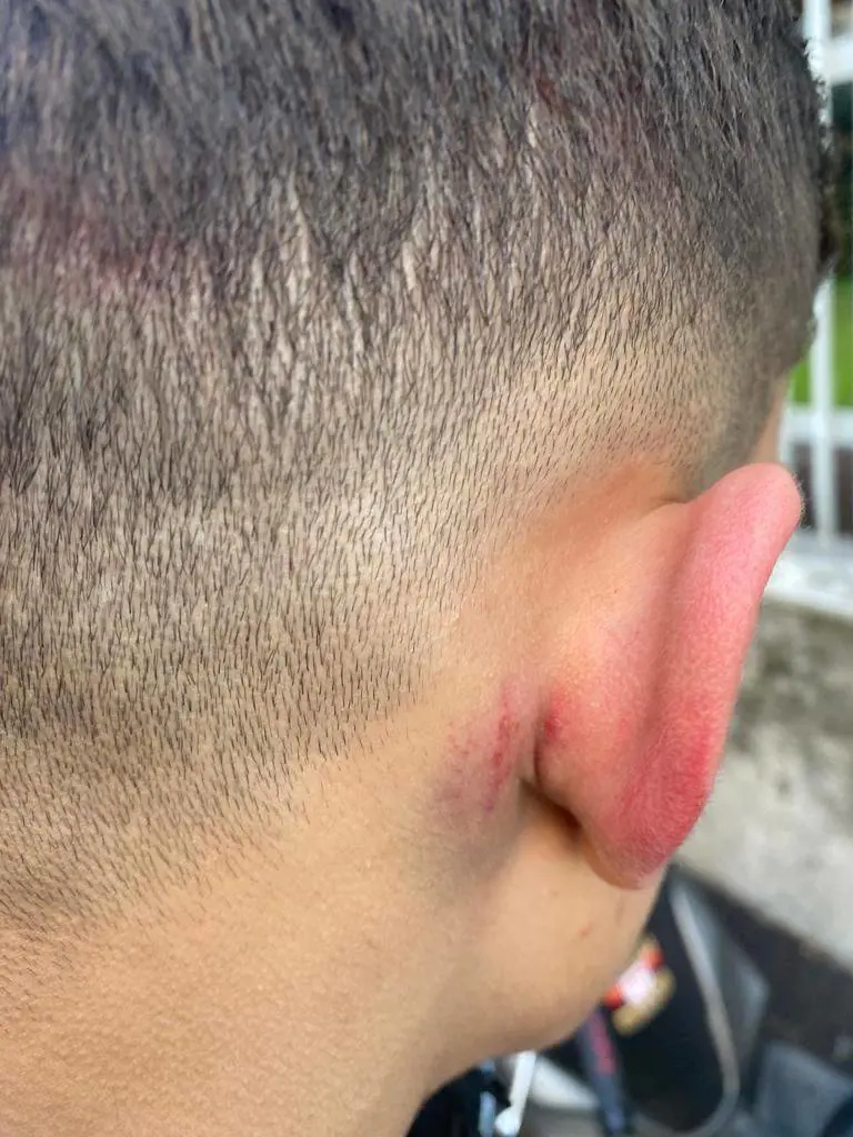 “Potevano ammazzarli”: ancora violenza nella notte a Milano. Due minorenni in ospedale