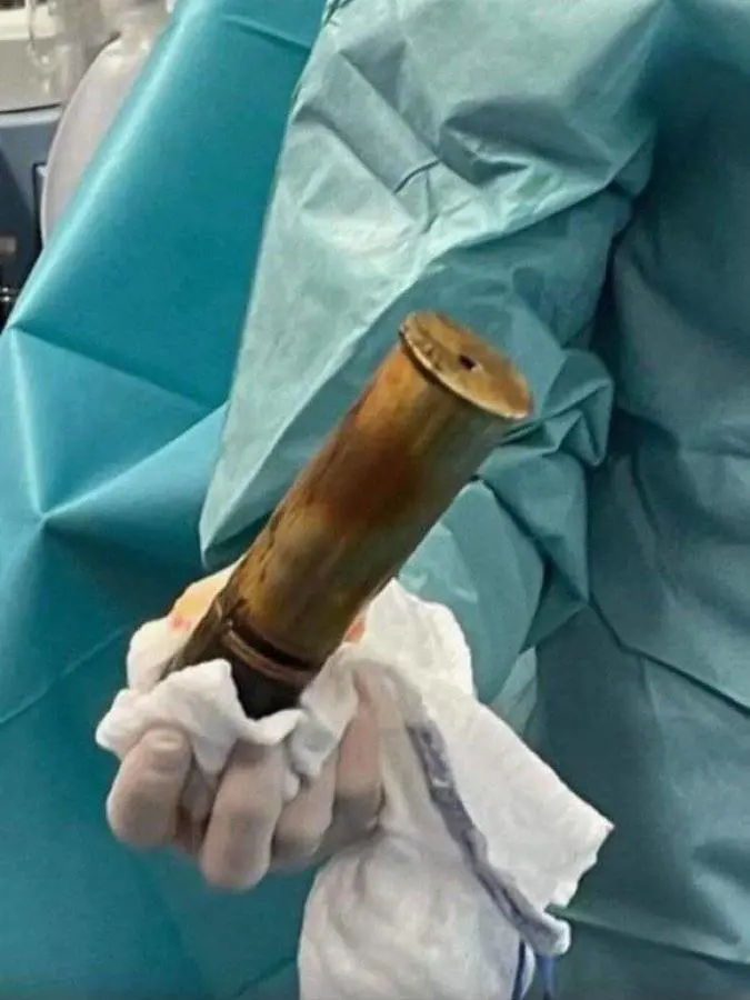 Choc in ospedale: così l'anziano ha fatto scattare l'allarme bomba