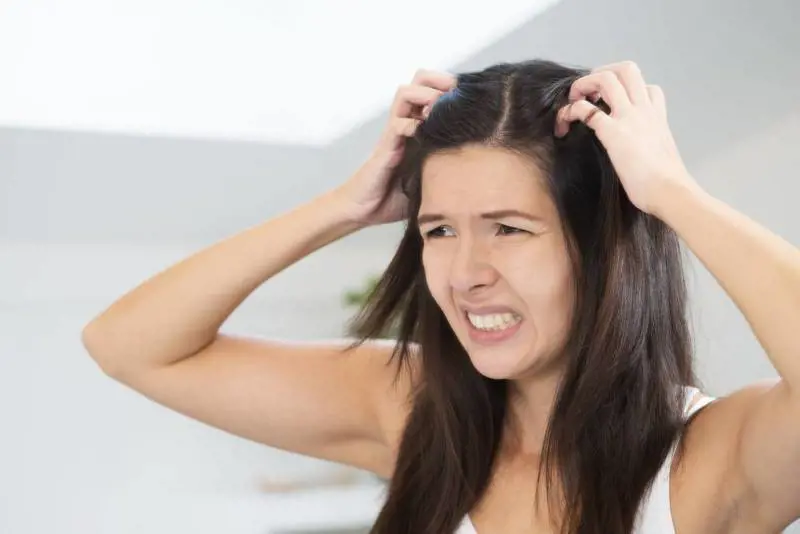 I rimedi naturali per combattere la dermatite seborroica