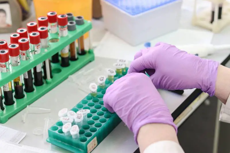 Artrite reumatoide: nuove speranze di cura