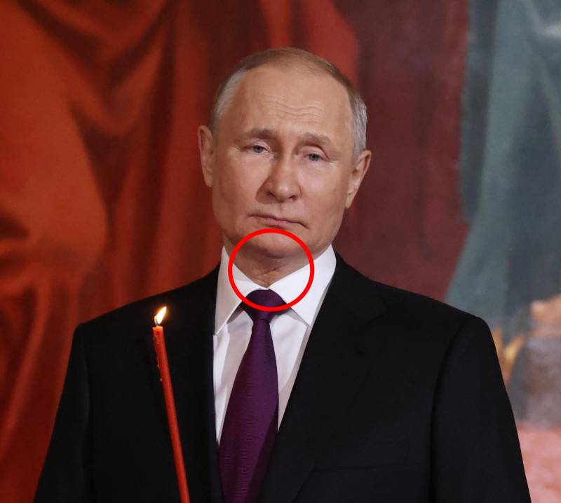 Putin cicatrice
