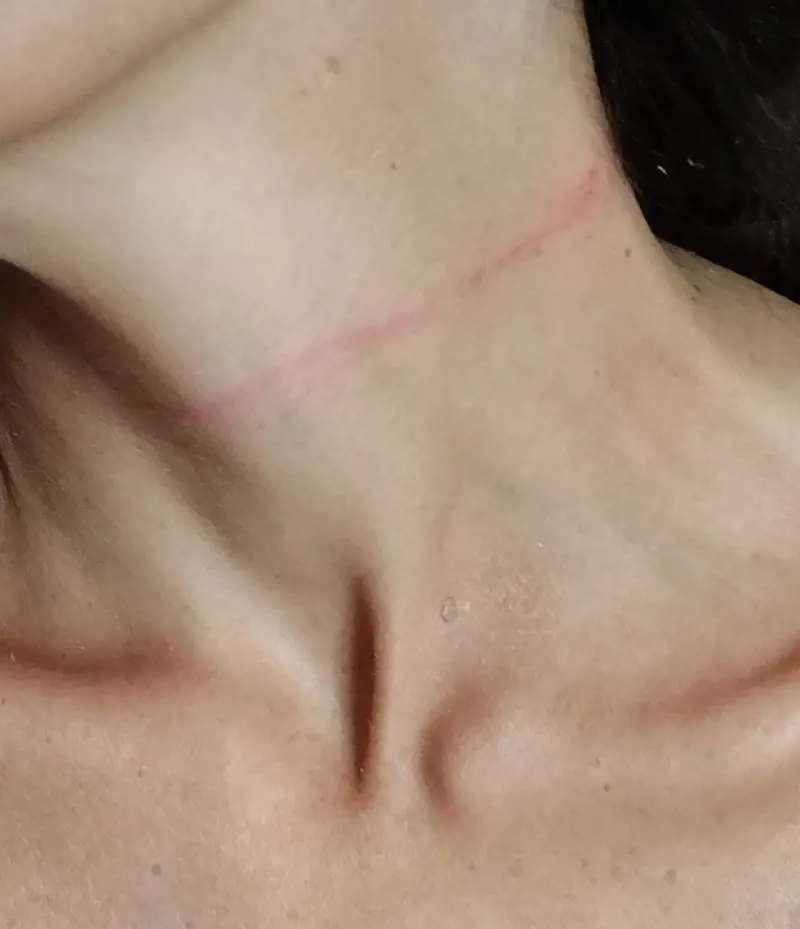 "Mi ha strappato la catenina, ero in trappola". L'incubo di una studentessa a Milano