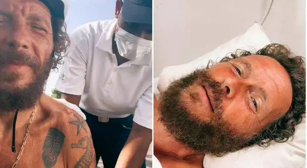Jovanotti e la caduta in bicicletta. "Femore e clavicola rotti, che male!"