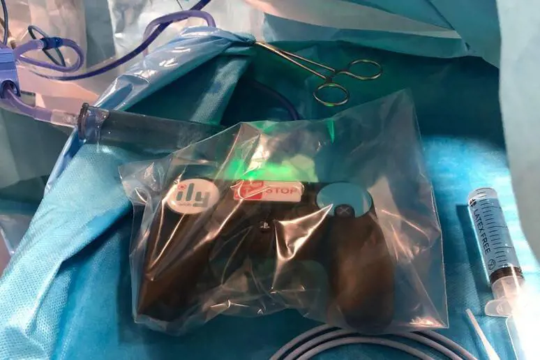 I calcoli renali? Operati con il  joystick della PlayStation