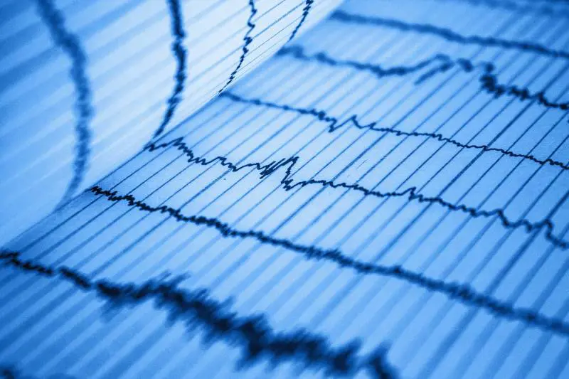 L’IA previene gli infarti: come funziona
