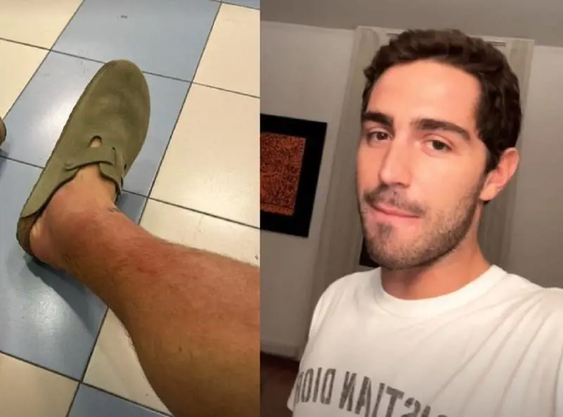 "Sospetta trombosi". Tommaso Zorzi finisce in ospedale, ma la diagnosi è un'altra