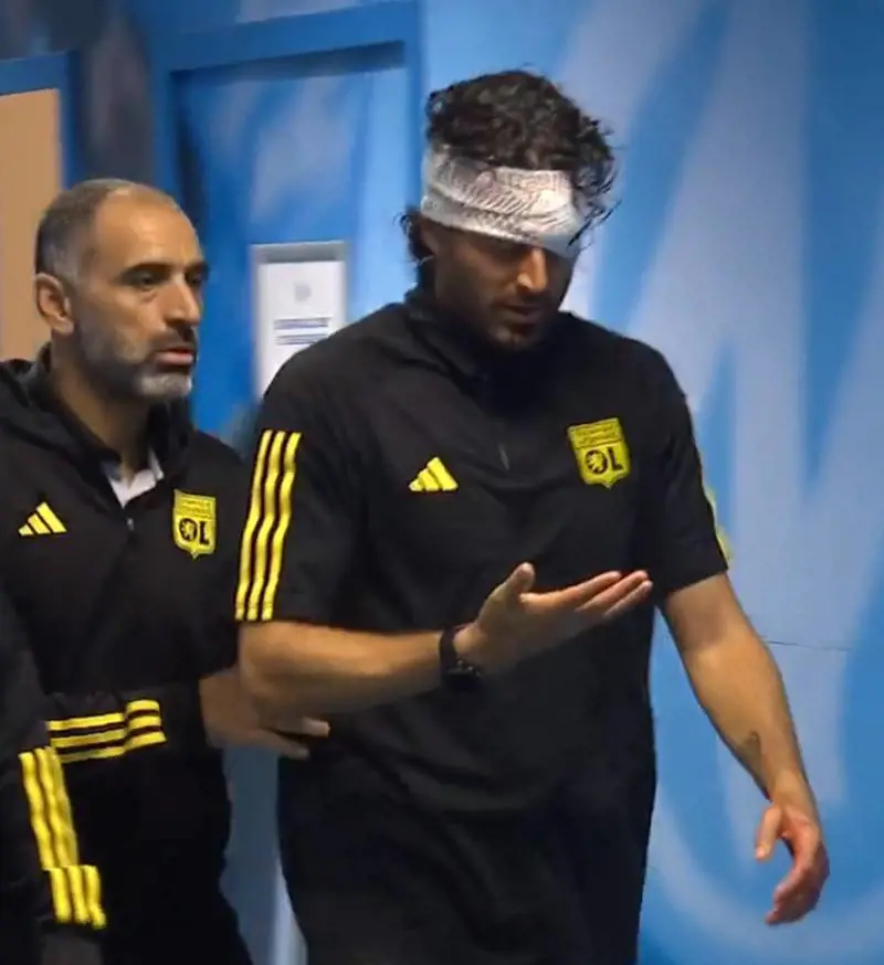 Lancio di sassi, ferito Grosso prima del match con Gattuso