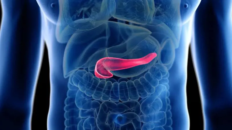 Tumore al pancreas, scoperti in ritardo 8 casi su 10: chi rischia di più