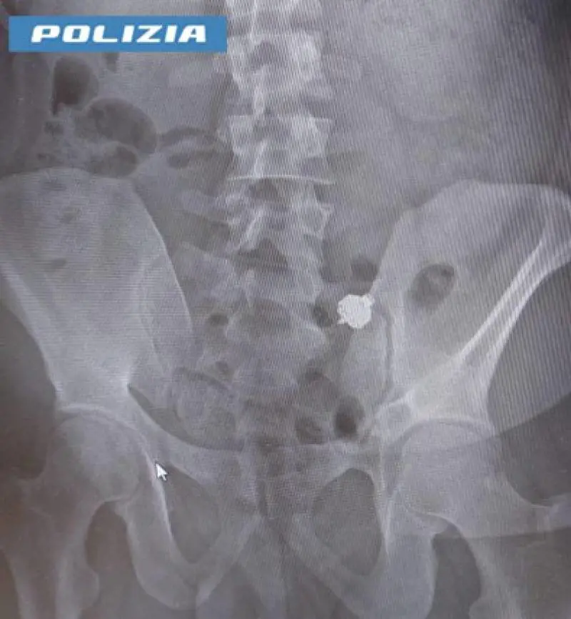 Bolzano, imbroglia durante l'esame per la patente, scoperto ingoia l'auricolare