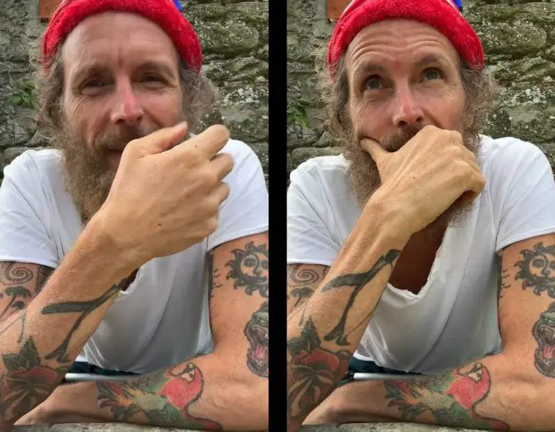 Jovanotti a 4 mesi dall'incidente: "Uso ancora le stampelle, i muscoli fanno male"