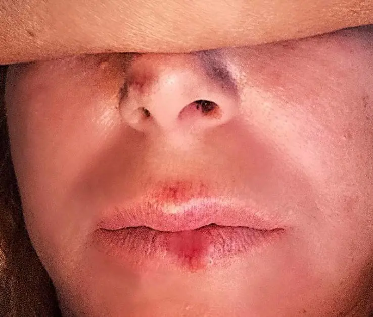 "Investita e insultata", il racconto choc di Monica Leofreddi