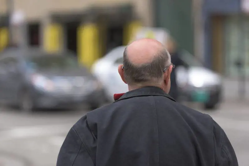 L'allarme sul farmaco contro la caduta dei capelli: cosa provoca