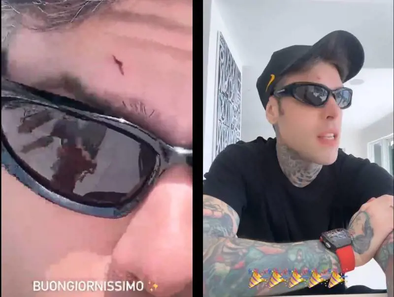 Fedez a Miami, infortunio e valigia persa: un viaggio da incubo