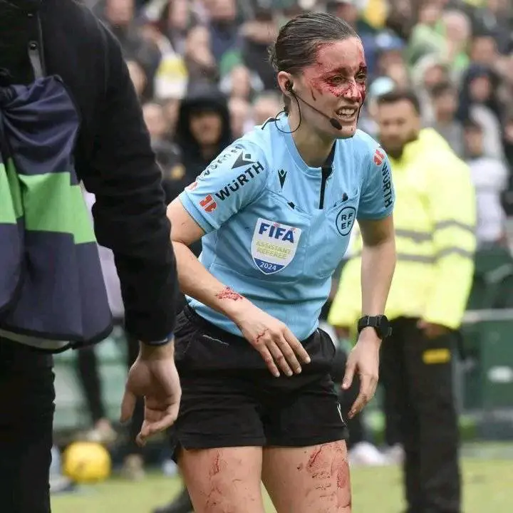 Il guardalinee, il volto pieno di sangue e il trauma: cos'è successo in Liga