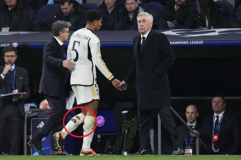 Ecco perché i calciatori tagliano i calzettoni