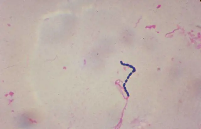 Un "batterio carnivoro" spaventa il Giappone: "Alta mortalità"