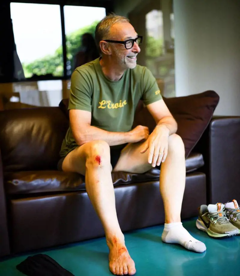 "Ho preso una buca e sono volato via...". Incidente in vespa per Linus 