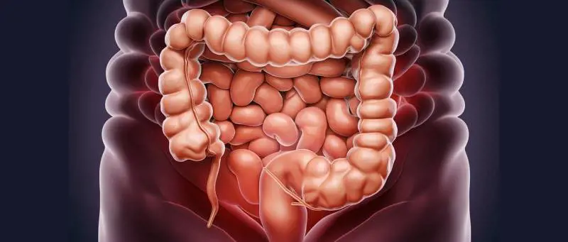 Tumore al colon-retto, quali sono i sintomi iniziali: ecco come avviene la diagnosi