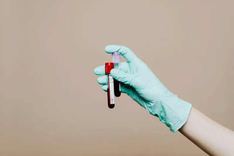 Trigliceridi alti, causano diabete e possono provocare infarti: come abbassarli