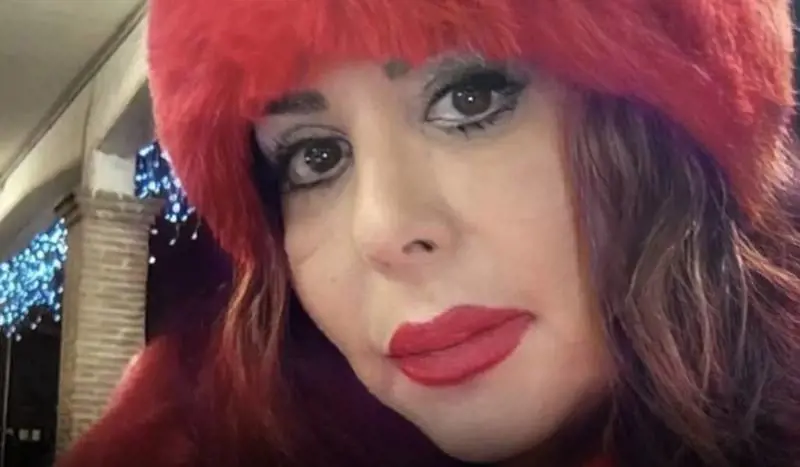 Donna muore per una liposuzione dopo una lunga agonia: "Infezioni ovunque", il chirurgo era recidivo