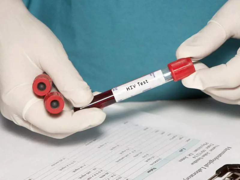 Test dell'HIV: come e quando sottoporsi al test