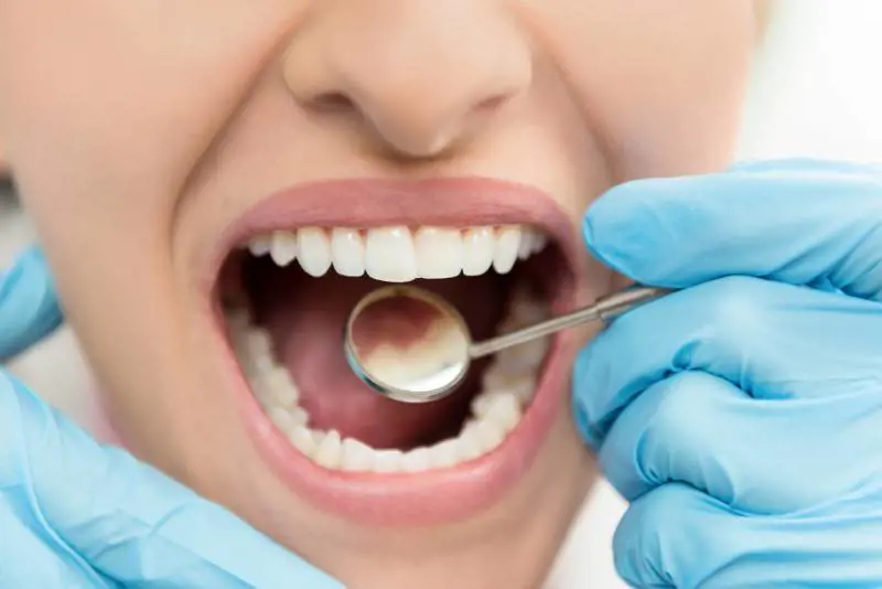 Un problema dentale può essere spia di altre patologie?