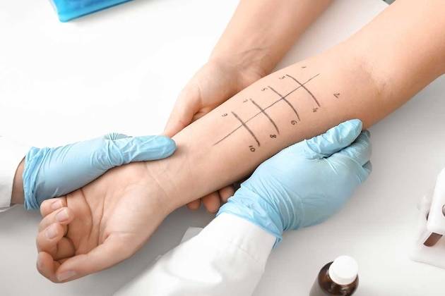 Quali test fare per valutare se si è allergici?
